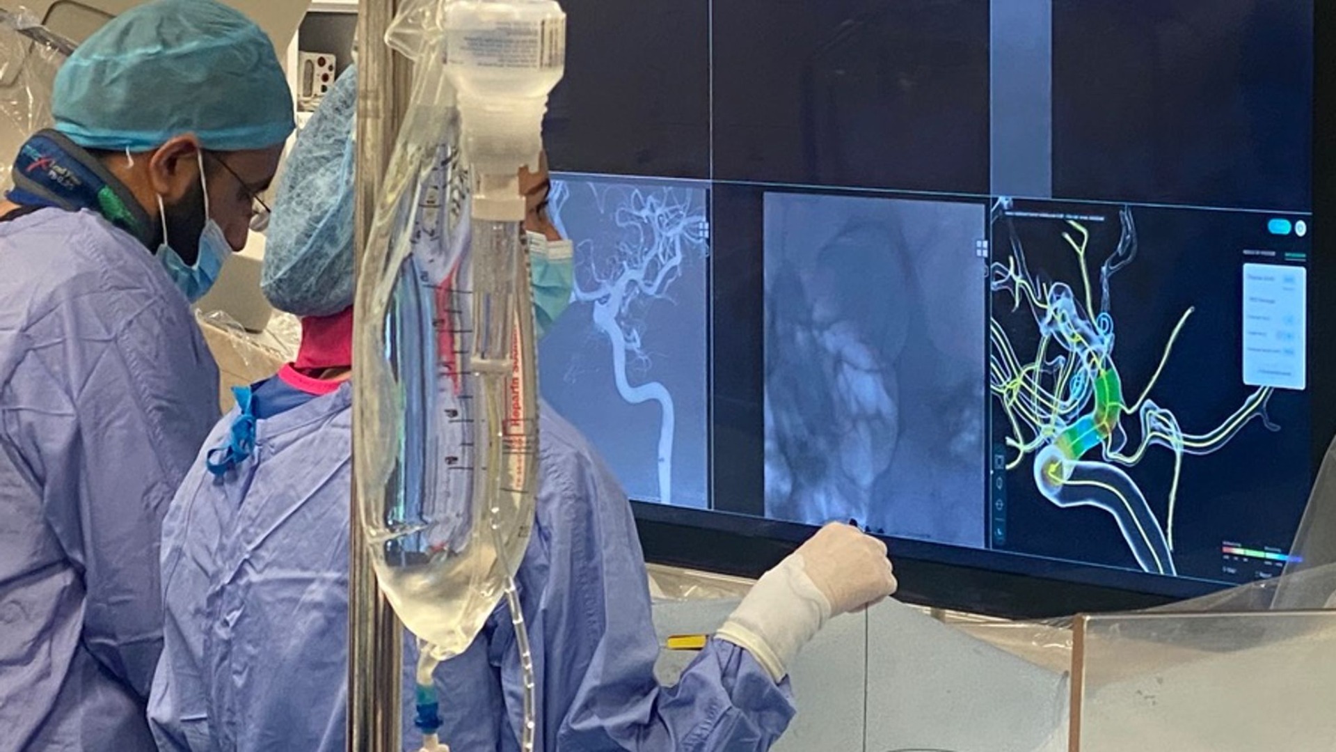 AI-driven technology could transform aneurysm treatment